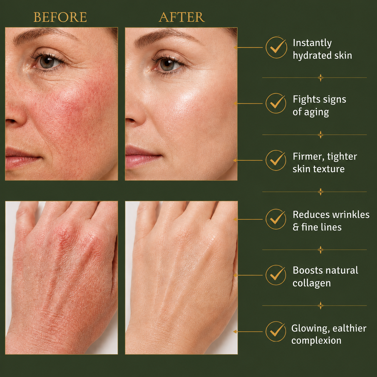 Natural Anti-aging Bee Venom Rynex™  Cream